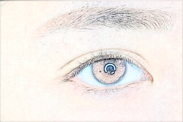 2024佛山市第二人民醫(yī)院全飛秒激光價格?全飛秒激光后遺癥