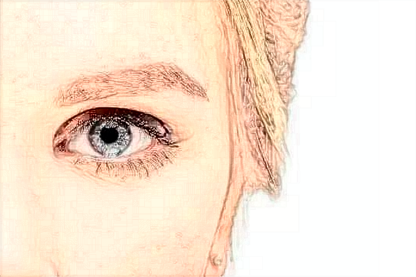 2024臨沂市人民醫(yī)院全飛秒手術(shù)價格?全飛秒手術(shù)利弊