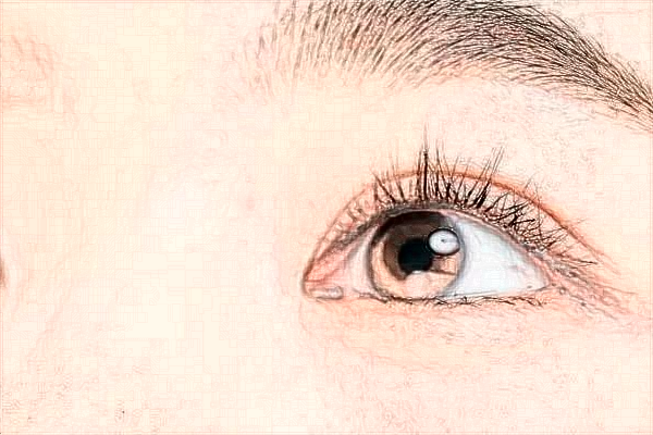 臨沂市人民醫(yī)院飛秒手術(shù)好嗎?飛秒手術(shù)適合多少度近視