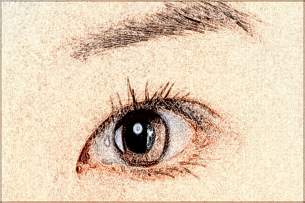 2024佛山市第二人民醫(yī)院去眼袋怎么樣?去眼袋手術(shù)恢復(fù)期