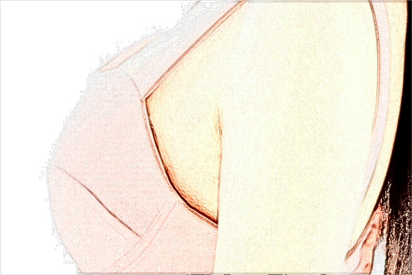 河北省人民醫(yī)院隆胸做的怎么樣_哪位醫(yī)生技術(shù)比較好