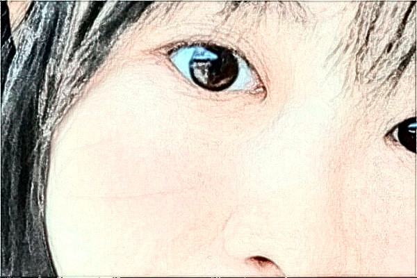 南通大學附屬醫(yī)院光子嫩膚多少錢?醫(yī)生名單推薦