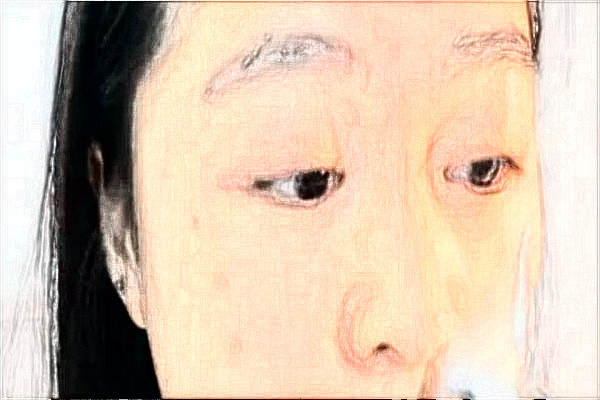 鎮(zhèn)江江濱醫(yī)院光子嫩膚價(jià)目表_口碑怎么樣