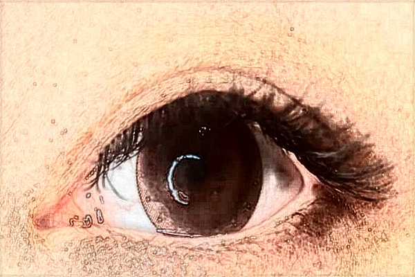 2024?？谑腥嗣襻t(yī)院近視激光手術(shù)費用?近視手術(shù)需要多久