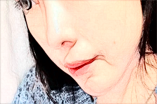 蘭州大學(xué)第二醫(yī)院整形美容科怎么樣?可以隆鼻嗎