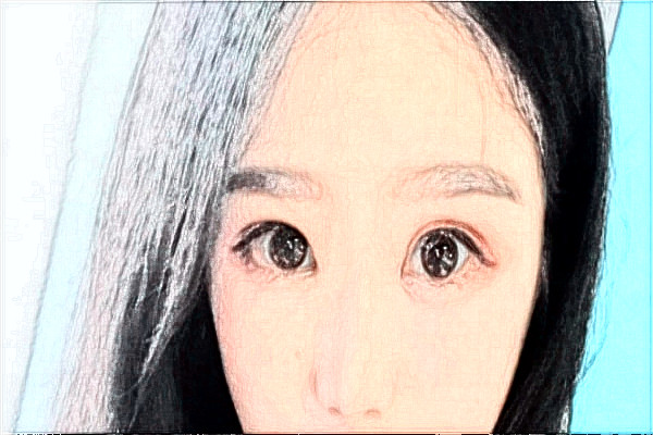 株洲市中心醫(yī)院激光近視手術怎么樣?2024全飛秒貴嗎?