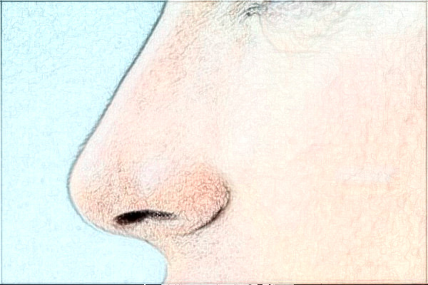 2024安徽省立醫(yī)院隆鼻怎么樣_誰(shuí)做得好