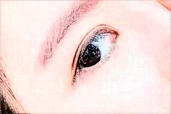 2024延邊醫(yī)院去除眼袋案例反饋，做過的都說不錯