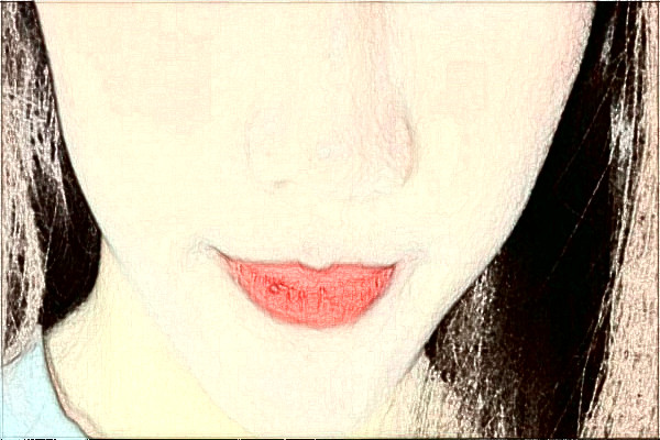 2024大連大學(xué)附屬新華醫(yī)院激光脫毛怎么樣?全新案例分享