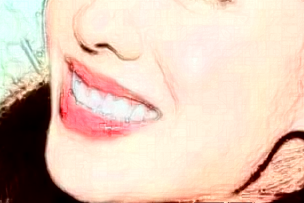 2024太原眾牙口腔醫(yī)院冷光美白怎么樣_體驗日記分享