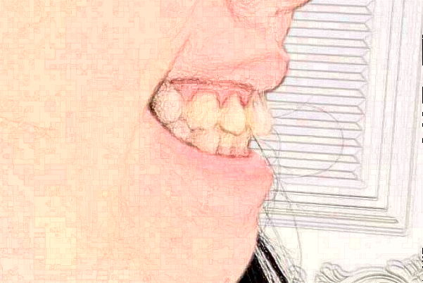 南京中大醫(yī)院口腔科拔牙怎么樣_整形日記分享