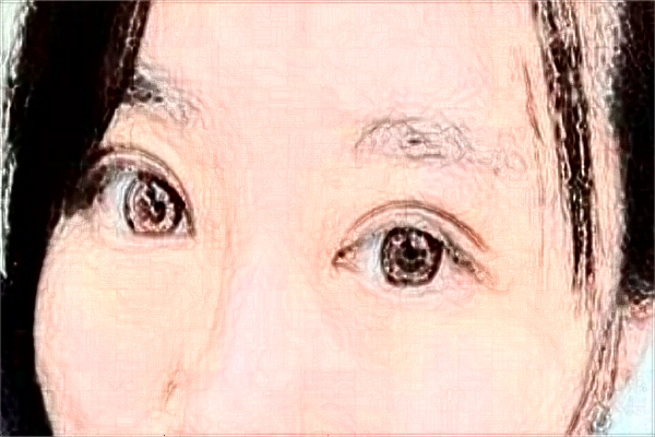 安徽醫(yī)科大學(xué)第一附屬醫(yī)院做雙眼皮價(jià)目表(價(jià)格表)怎么樣