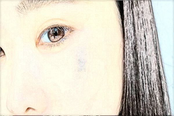 南京鼓樓醫(yī)院去胎記做的好嗎？誰做的好