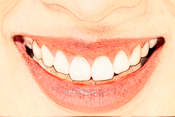 2024徐州醫(yī)科大學附屬醫(yī)院種植牙做的好嗎_醫(yī)生推薦