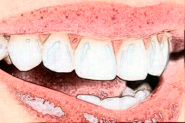 蘇州康美美容醫(yī)院虎牙矯正怎么樣_誰(shuí)做得好