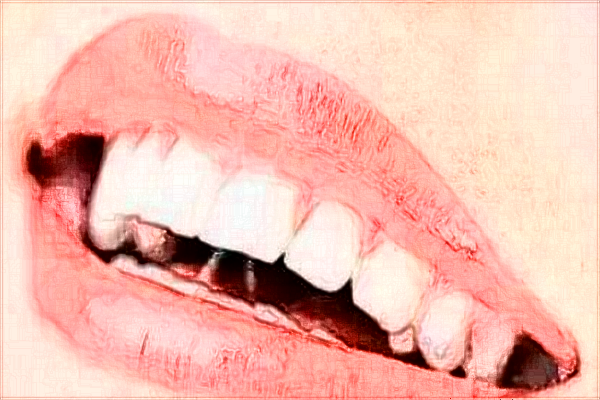 2024海口市人民醫(yī)院補(bǔ)牙縫收費(fèi)標(biāo)準(zhǔn)?補(bǔ)牙醫(yī)生