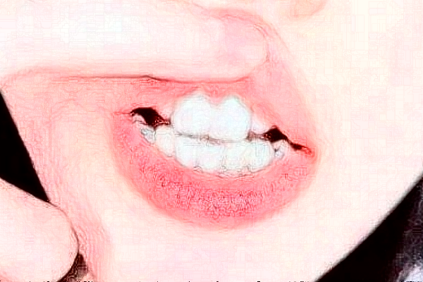 中山大學(xué)附屬口腔醫(yī)院補(bǔ)牙怎么樣?補(bǔ)牙醫(yī)生推薦名單