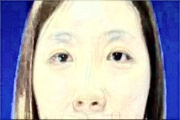 2024徐州醫(yī)科大學(xué)附屬醫(yī)院激光祛斑怎么樣_醫(yī)生介紹