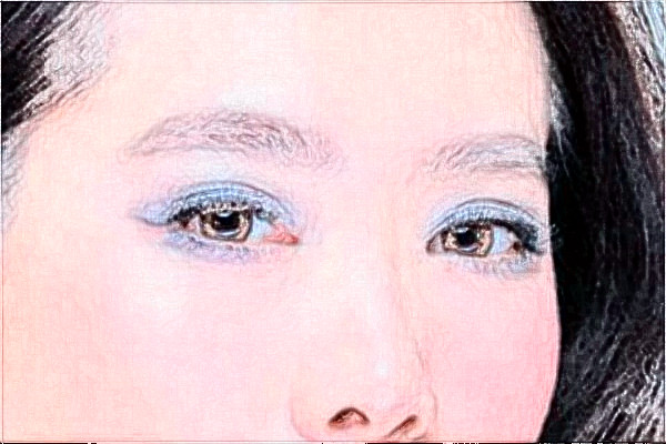 安徽醫(yī)科大學(xué)第一附屬醫(yī)院去眼袋做的好嗎?哪位醫(yī)生做得好