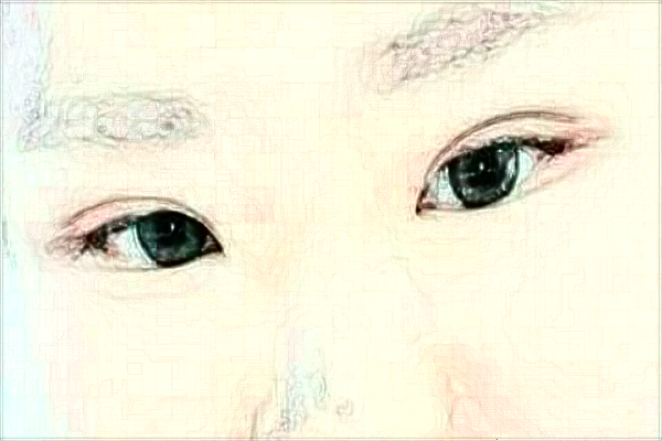 徐州醫(yī)科大學附屬醫(yī)院去眼袋做的好嗎?哪位醫(yī)生做得好