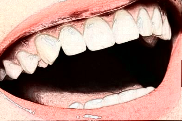 2024齊齊哈爾市中醫(yī)院烤瓷牙怎么樣_誰(shuí)做得好