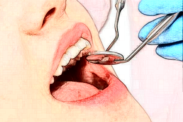 長沙好大夫口腔醫(yī)院種植牙費(fèi)用多少_醫(yī)生名單