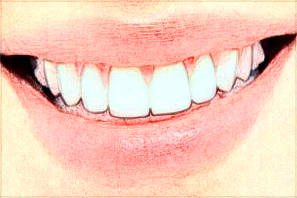 海口市人民醫(yī)院正畸科哪個醫(yī)生好?2024正畸收費價格?