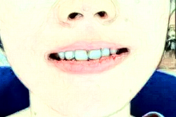 ?？谑腥嗣襻t(yī)院正畸科哪個醫(yī)生好?2024正畸收費價格?