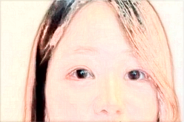 2024珠海市人民醫(yī)院祛痣多少錢?祛痣掛什么科