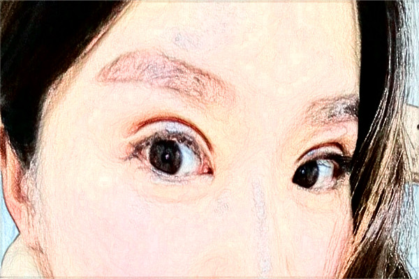 煙臺(tái)毓璜頂醫(yī)院熱瑪吉好嗎?2024熱瑪吉收費(fèi)價(jià)格