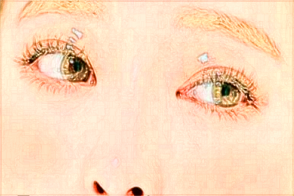 煙臺(tái)毓璜頂醫(yī)院隆鼻怎么樣?假體隆鼻能保持幾年?