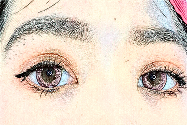 2024煙臺(tái)毓璜頂醫(yī)院飛秒激光價(jià)格?飛秒激光手術(shù)的利弊