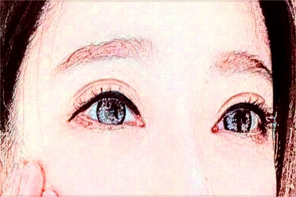 2024懷化市第一人民醫(yī)院飛秒價格?飛秒激光好不好?