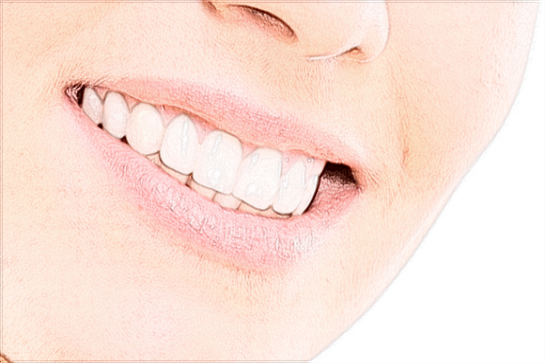 ?？谑腥嗣襻t(yī)院牙齒矯正年齡范圍?牙齒矯正費用