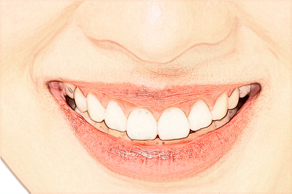 青島市立醫(yī)院種植中心好嗎?2024單顆牙種植的費用