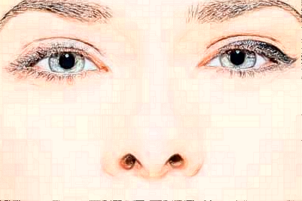 2024徐州醫(yī)科大學附屬醫(yī)院隆鼻多少錢_醫(yī)生名單推薦