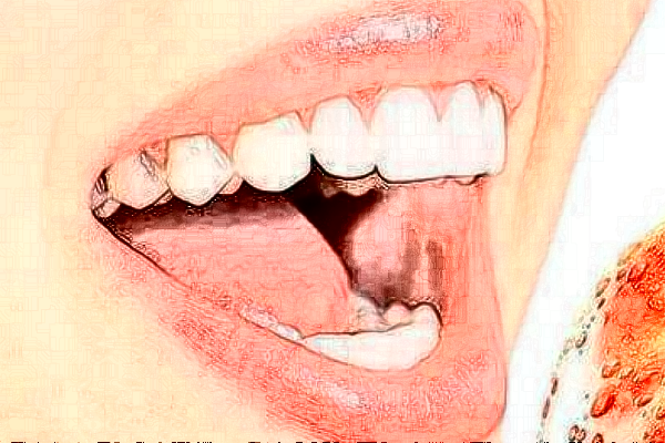 河北大學(xué)附屬醫(yī)院全瓷牙怎么樣_案例_價(jià)格