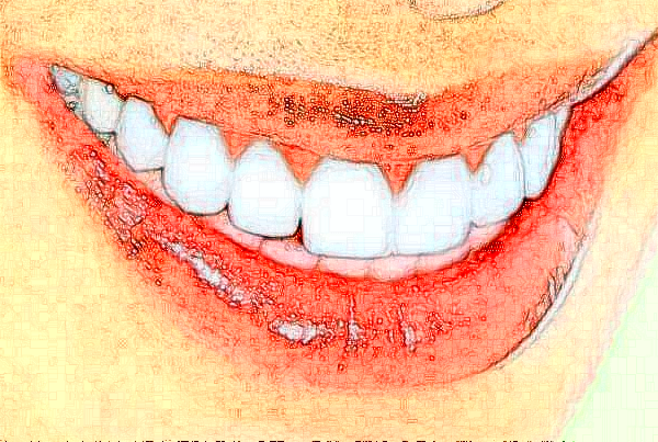 河北大學(xué)附屬醫(yī)院全瓷牙怎么樣_案例_價(jià)格