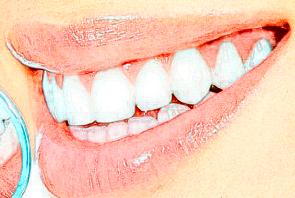 2024河北大學附屬醫(yī)院種植牙齒費用多少_醫(yī)生名單