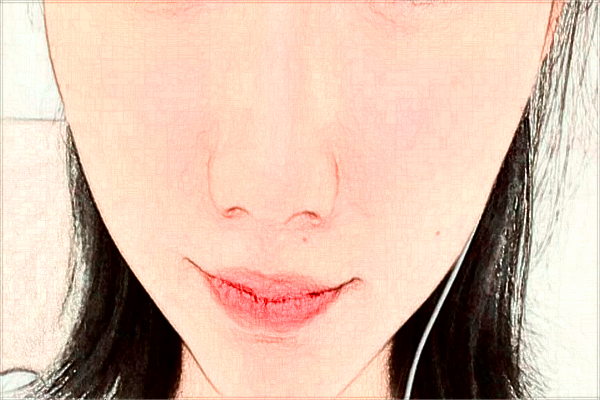 煙臺中醫(yī)院光子嫩膚好不好?2024光子嫩膚收費價格