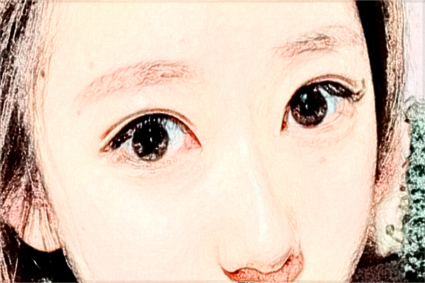 2024?？谑腥嗣襻t(yī)院飛秒手術(shù)價(jià)格?飛秒手術(shù)后注意事項(xiàng)