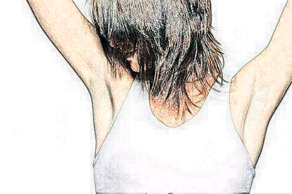 揚(yáng)州市第一人民醫(yī)院去腋臭做的好嗎?整形日記分享