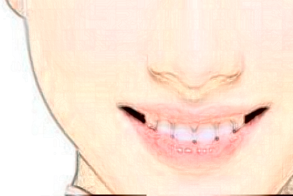 2024延邊醫(yī)院祛斑價(jià)格是多少?那個(gè)醫(yī)生好