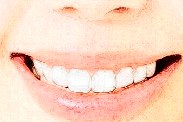 2024安徽醫(yī)科大學(xué)第一附屬醫(yī)院牙套價格需要多少_真實案例分享