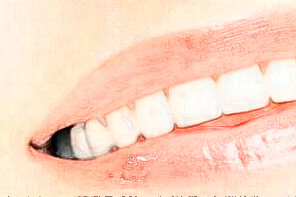 2024天津南開(kāi)醫(yī)院烤瓷冠怎么樣|醫(yī)生介紹|價(jià)格收費(fèi)