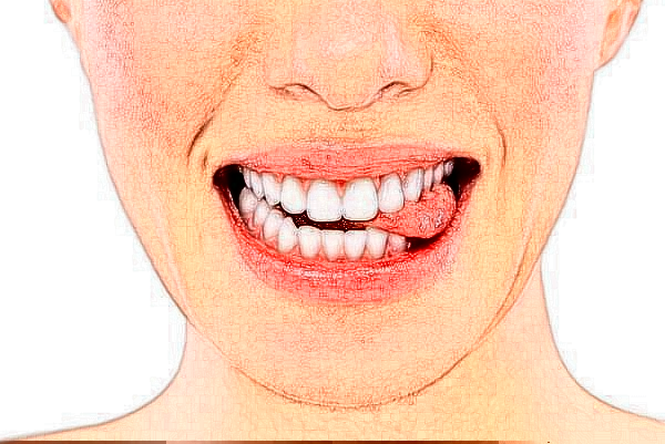 2024徐州醫(yī)科大學(xué)附屬醫(yī)院正畸價格需要多少_真實案例分享