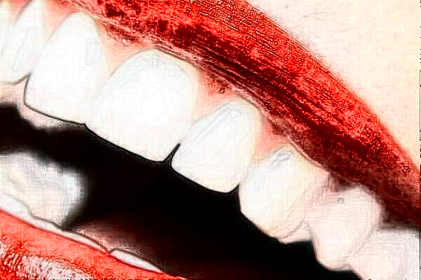 2024山西省人民醫(yī)院牙齒矯正費用多少?整形日記全過程