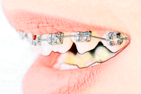 2024遼寧省人民醫(yī)院拔牙怎么樣|醫(yī)生介紹|價格收費(fèi)