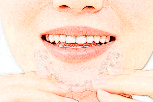 2024銅陵市人民醫(yī)院補牙怎么樣_案例分享