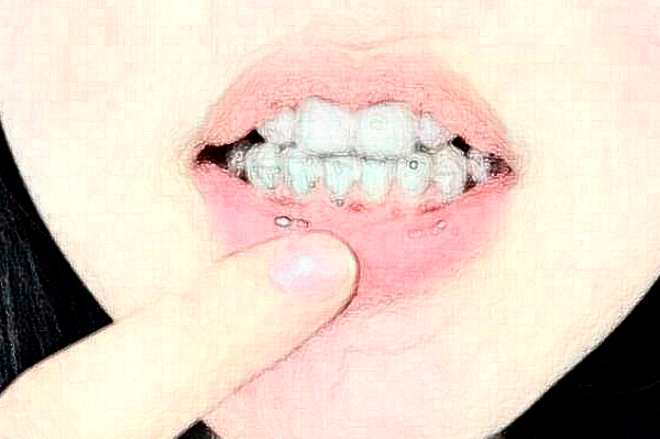 天津南開醫(yī)院全口義齒怎么樣_案例_價格